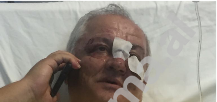 “PAS DEBATIT MË KËRCËNOI”/ Flet avokati që u dhunua në Durrës: PROKURORI që ma bëri këtë do ta paguajë… (EMRAT)