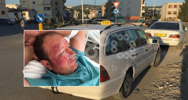 Sherr për parkimin, grushte në kokë e trup taksistit, përfundon në spital: Më futën në bagazh (VIDEO)