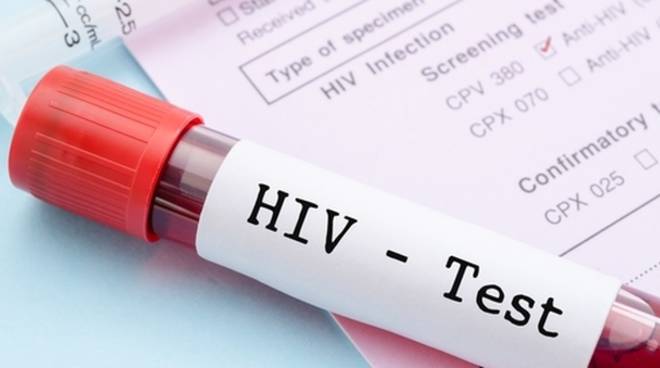 Vaksina kundër HIV, shpikja premtuese për njerëzimin. Pritet të lançohet…