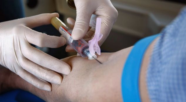 Trajtohen për HIV/AIDS edhe qytetarët në Kosovë