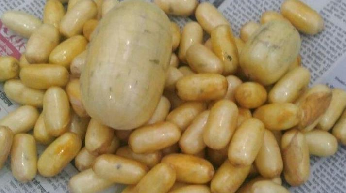 TURQI/ Arrestohet gjermani, kishte fshehur 1.3 kg kokainë në stomak