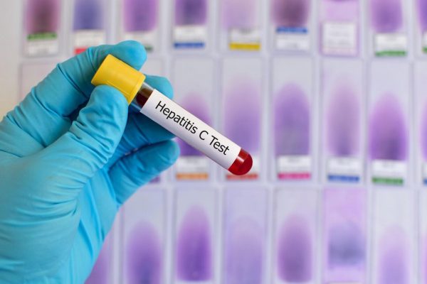 Çfarë duhet të dini për hepatitin dhe llojet e tij