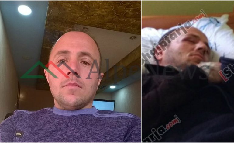 U SULMUA NGA ARIU/ Ja kush është i riu nga Kukësi që u përlesh me kafshën e egër dhe shpëtoi për “një fije” (FOTO)
