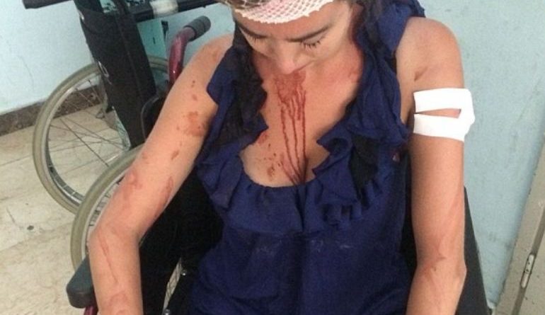 REFUZOI ÇMIMET E “KRIPURA”/ 26-vjeçarja rrihet nga pronari i hotelit