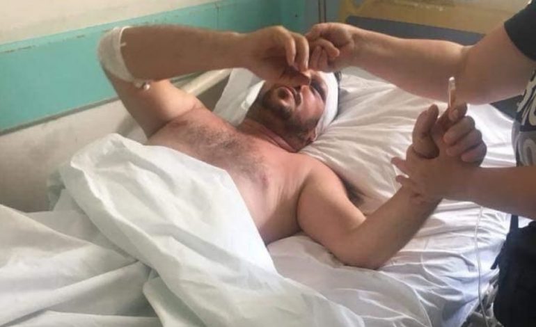 U PËRPLAS ME TRENIN PËR NJË QEN/ FOTO: Kosovari pëson traumë. I gjakosur dhe i shtrir nuk lëviz dot