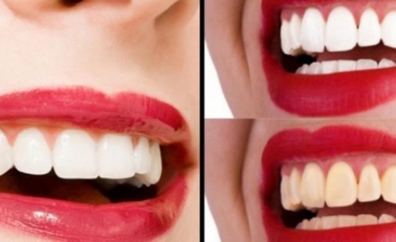 Lamtumirë dentist! Ja si ti zbardhi dhëmbët në shtëpi