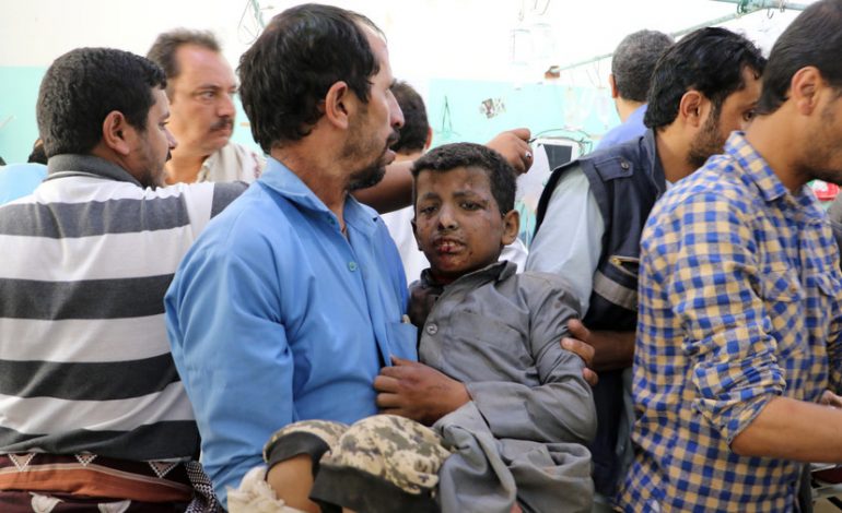 SULMI NDAJ AUTOBUSIT ME NXËNËS/ Rritet numri i viktimave nga në Jemen