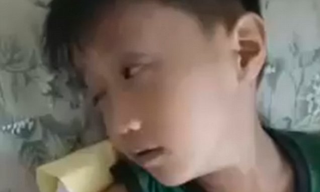 Luante 9 orë lojra në smartphone, djali pëson paralizë faciale… (VIDEO)