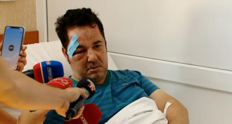 DHUNA NDAJ BIZNESMENIT/ Policia sekuestroi kamerat e sigurisë, por ende asnjë i identifikuar