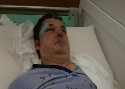 DHUNIMI I BIZNESMENIT/ Ja kush është personi që u godit nga disa persona (EMRI)