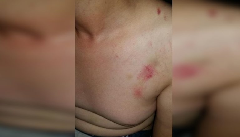 DHUNIMI I FËMIJËS ME AUTIZËM/ Flet babai: Si im bir, keqtrajtoheshin edhe të tjerë (VIDEO)