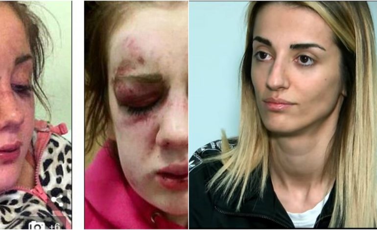 “XHISIELA”/ Si ranë në KURTH mediat për FOTON e vajzës së dhunuar. Bllofi me ngjarjen dhe e vërteta