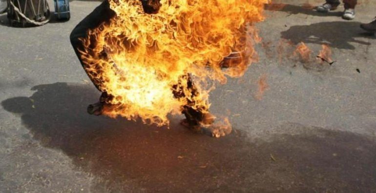 E RËNDË NË SHKODËR/ Djeg mbeturinat, burri DIGJET edhe vetë. VDES pas…