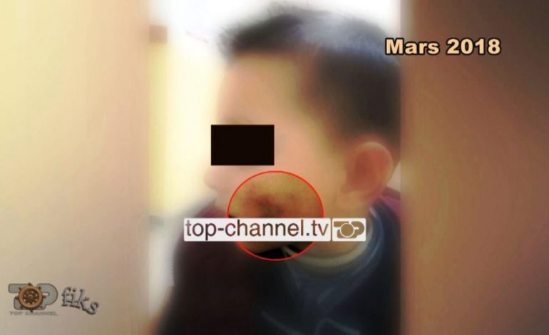 5 VJEÇARI U DHUNUA NGA I ATI ME THUPËR/ Përmbaruesi i kthehet nënës: Ça fëmija jot moj ça fëmija jot…