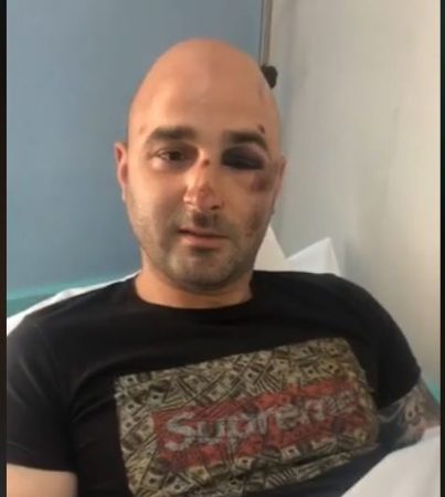 “U QËLLUA NË KËMBË NGA POLICIA”/ Deputetët e PD vizitojnë 24 vjeçarin në spital