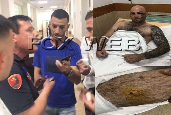 E PLAGOSI POLICIA/ 24 vjeçari MIK i Stresit. Këngëtari SHPËRTHEN në spital: Do t’ja q* m r*** krejtve (VIDEO)