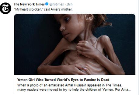 E DHIMBSHME/ Yemen, vdes Amal, vajza simbol e vuajtjeve të luftës
