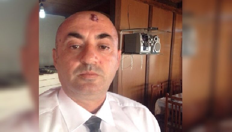 DENONCIMI/ Si u kërcënua me jetë nga DY GRA kryeinspektori i IMT-së (EMRAT)