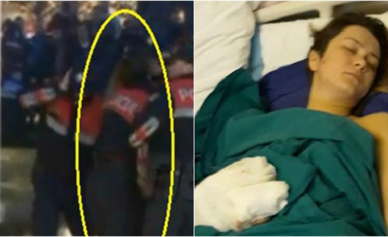 PAS 7 ORË OPERACION/ Ja si është gjendja e POLICES që u PLAGOS me kapsolle (FOTO)