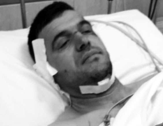 “SHKULA NJË DRU GARDHI DHE E QËLLOVA NË KOKË”/ Vjehrri: E vrava dhëndrin sepse…