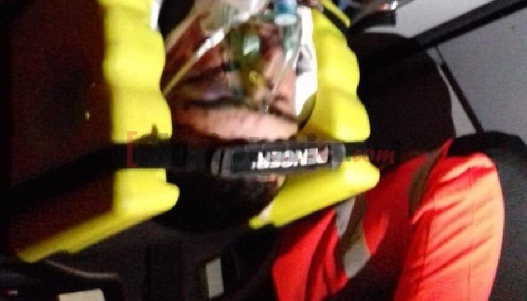 BIE NGA URA ME MOTOR/ 39-vjeçari në gjendje kome transportohet në Tiranë