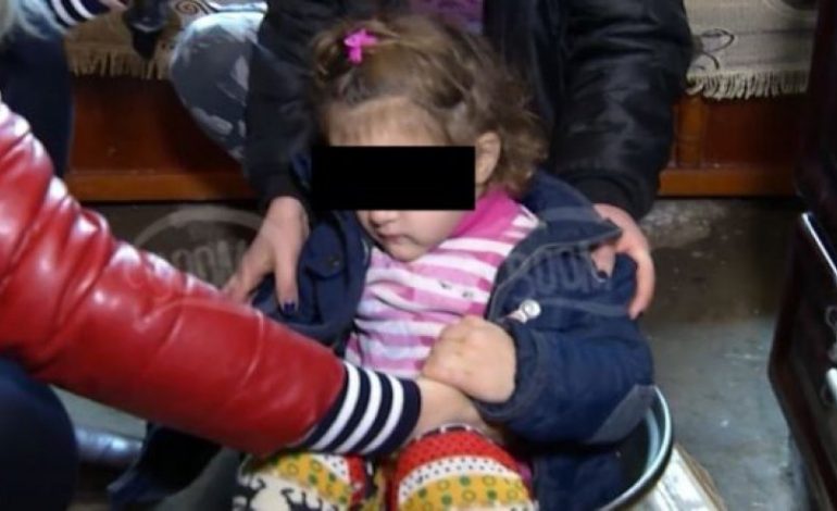 E DHIMBSHME/ Katër vjeçarja shqiptare përvëlohet nga qumështi, motra tregon tmerrin