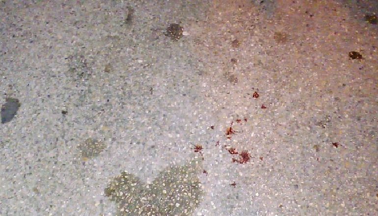 ISHTE DUKE DEBATUAR ME AUTORIN/ Qëllohet me kaçavidë në kokë biznesmeni shqiptar