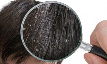 SHMANGINI SA MË SHUMË TË MUNDENI/ 4 faktorë të jashtëm që krijojnë zbokthin në flokët tuaj