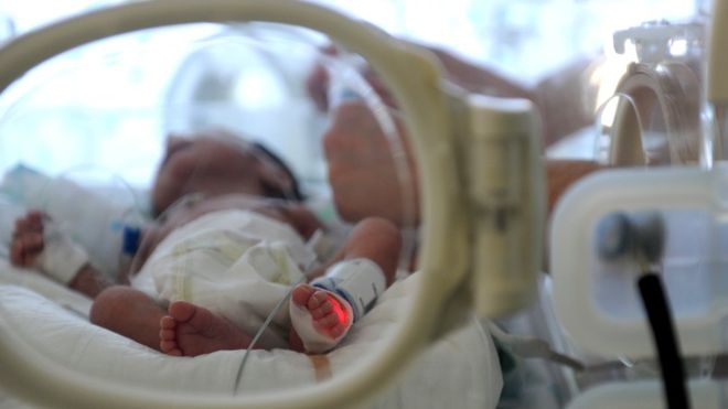 NJË MREKULLI/ Nëna me trurin e vdekur prej tre muajsh lind foshnjën