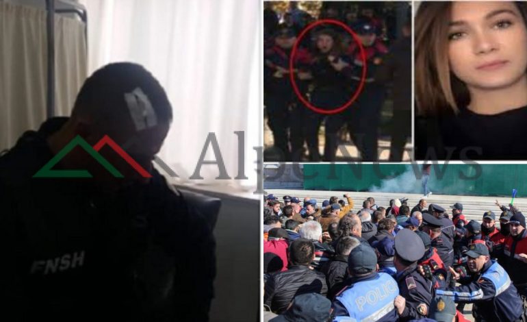 KUR OPOZITA “MAT FORCËN” ME POLICINË/ Si po i sulmojnë militantët PA MOTIV, efektivët (FOTOT)