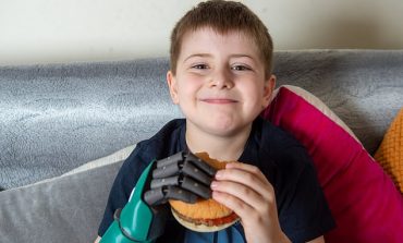 TANI MUND TË HAJË HAMBURGER.../ 8-vjeçarit i ndryshon jeta pasi i vendosin protezën që...