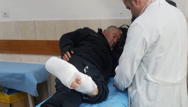 “MAKINA NË FLAKË FALSE”/ PD “zgjohet” me akuza për skenare të “fshehura”: Ka policë të dhunuar?!