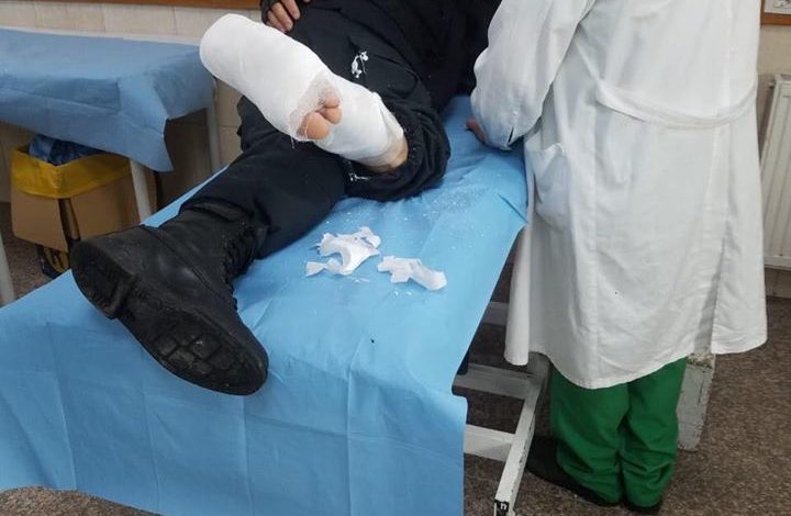 DALIN PAMJET/ Këta janë efektivët e policisë që u PLAGOSËN nga protestuesit e opozitës
