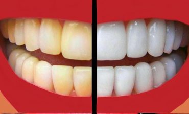 MËSOJINI TANI/Pesë rregullat e arta për dhëmbë të bardhë dhe të pastër