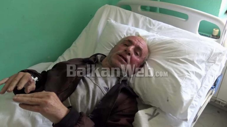 “S’KEMI BUKË TË HAMË, DOJA TË VDISJA”/ Rrëfimi i dhimbshëm i burrit që i vuri flakën vetes (VIDEO)