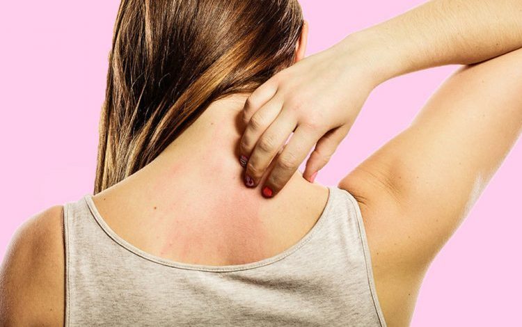 TEMPERATURAT E LARTA/ Dermatologia: Ja si të mbroheni më mirë nga dielli