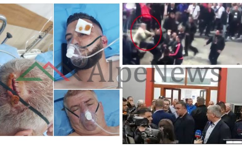 “LUFTA POLITIKE” VAZHDON/ Përplasjet për të vërtetën se kush i “MASAKROI” protestuesit (VIDEO)