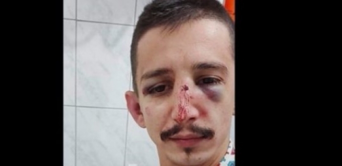 “ME SY TË NXIRË DHE I GJAKOSUR”/ Rrihet barbarisht gazetari shqiptar, flet pas ngjarjes: Më kanë tradhëtuar…(FOTO)