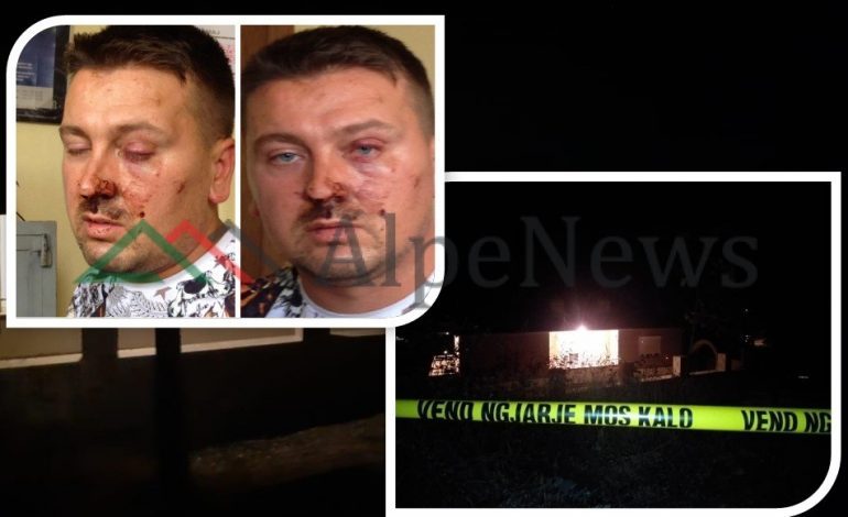 DËSHMIA/ Flet shënjestra që i shpëtoi atentatit në Korçë: Ja si ndodhi, problemin e vetëm e kam me policinë