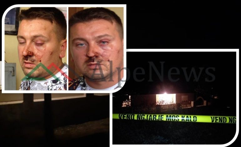 NGA DËNIMI PËR DROGË TEK, DHUNA PREJ SHEFIT TËPOLICISË/ Kush është JUXHIN KULLA, që u QËLLUA me armë në… (FOTO)