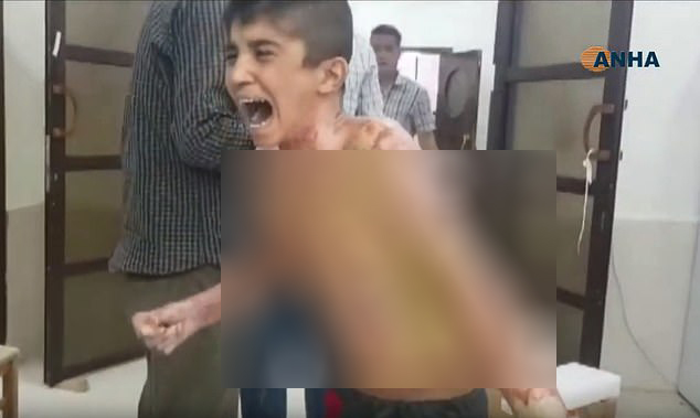 TMERR NË SIRI/ Ulëret fëmija: Babi të lutem ndaloje djegien. Turqia dyshohet për…