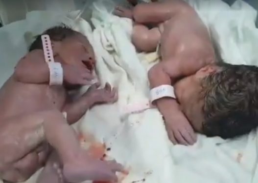 MREKULLI 20 MINUTA PAS TËRMETIT/ Mjekja: Simbolika më e mirë e vijimësisë së jetës (VIDEO)