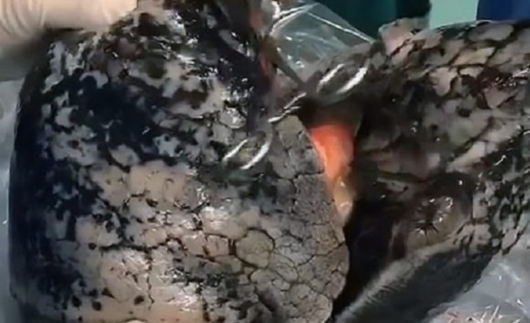 DALIN PAMJET SHOKUESE/ Mushkëritë e duhanpirësit që pinte një paketë në ditë