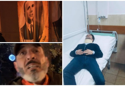 “TË Q*** MOTRËN”/ Laert Vasili përfundon në spital pas sherrit me aktorë të Teatrit Kombëtar: Budina më futi thonjtë në grykë