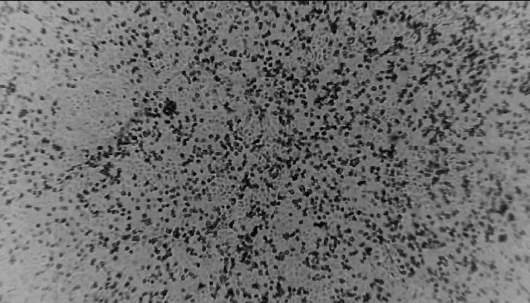 VIRUSI PO PËRHAPET ME SHPEJTËSI/ Koronavirus Wuhan merr një emër të ri zyrtar, ja si do të quhet tani