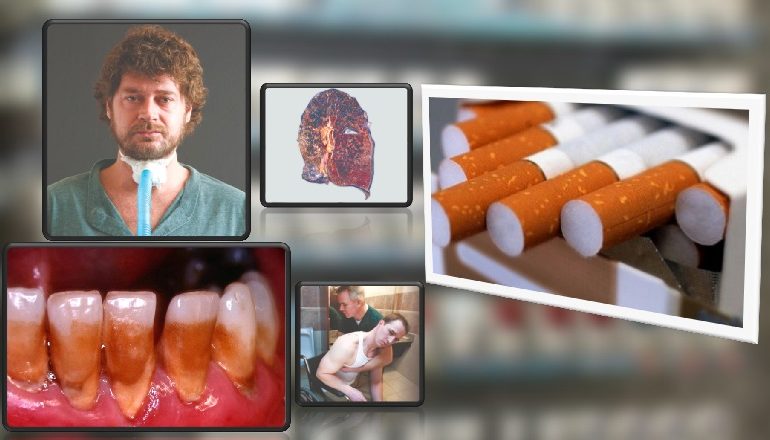 PAMJE HORROR NË PAKETAT E CIGAREVE/ Miratohen imazhet e reja të paketimit (FOTO)