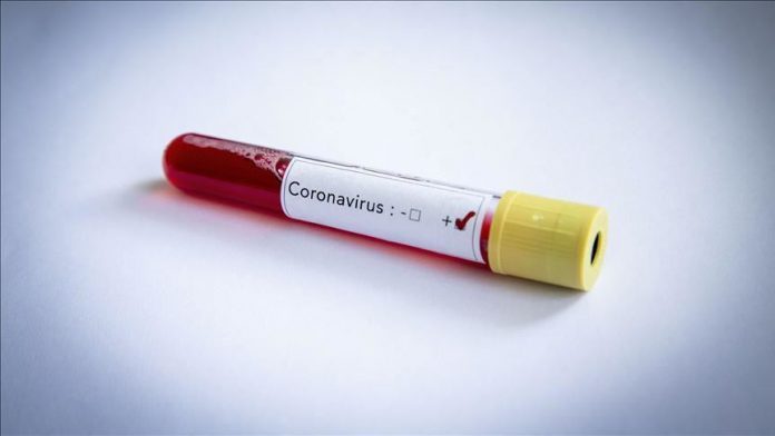 LAJM I SHUMËPRITUR/ Vaksina kundër koronavirus, thuajse gati