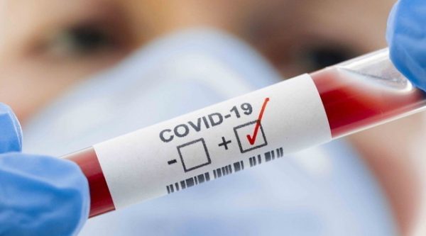 STUDIMI MBI KORONAVIRUSIN/ Revista “Science”: Për çdo rast të konfirmuar janë 5-10 të pazbuluar
