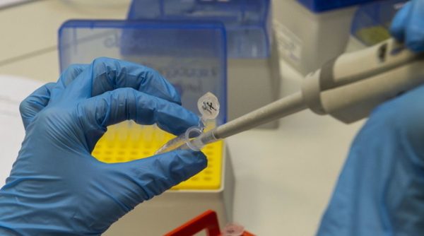KORONAVIRUS/ Në Londër kërkohen vullnetarë për t’u “infektuar”… Shkencëtaret: 4 mijë euro për të gjetur vaksinën