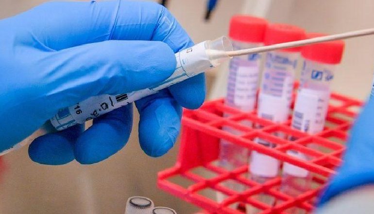 KORONAVIRUSI/ Medikamenti 70-vjeçar kundër malaries ofron “një fije” shprese në trajtimin e COVID-19